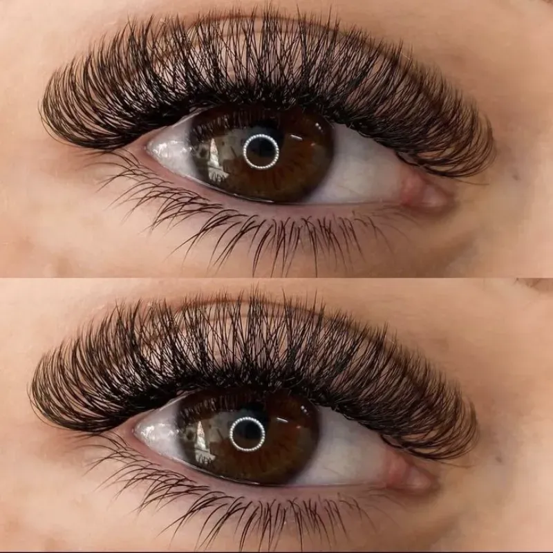 Retoque de volumen ruso